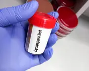 Record US cyclosporiasis outbreak worsened by Trump public health cuts, experts say