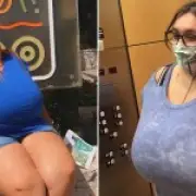 Texas Woman Loses Nipples After Breasts Grow from DD to P Cup, Blames IUD