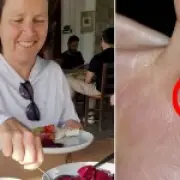 Woman bitten by bat on holiday saved by Google Lens rabies warning