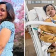 Woman loses part of face in tractor crash after traveling to India for depression