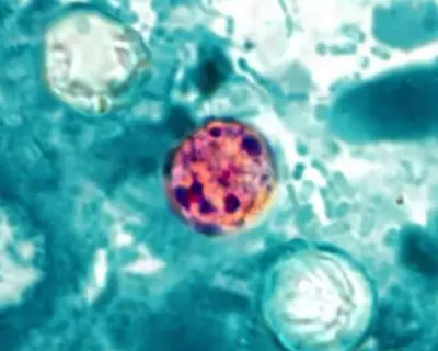 Cyclosporiasis outbreak: first US deaths reported in Michigan