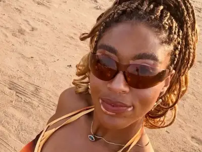 Love Is Blind UK Star Yasmin Reveals 20-Year Vitiligo Struggle