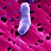 Louisiana sees surge in deadly flesh-eating bacteria cases
