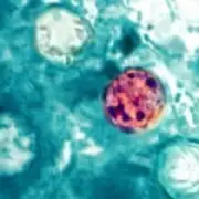 Two deaths linked to cyclosporiasis outbreak in US, CDC reports