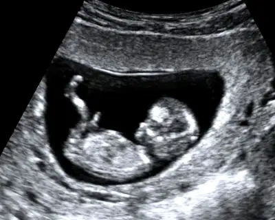 Family's abortion story: One Nation can't choose for us