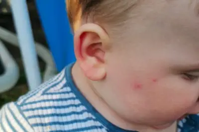 Sutton mum 'up all night' as bedbugs plague Carshalton home