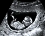 Family's abortion story: One Nation can't choose for us