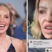 Katie Piper reveals vile abuse she faced after NTAs red carpet
