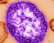 Six-week-old dies from measles in Pennsylvania, coroner says
